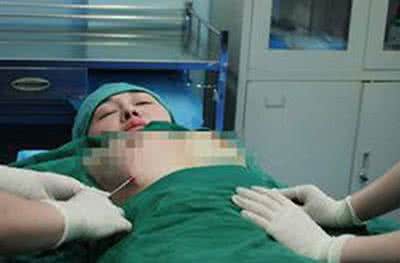 隆胸手术价格如何 隆胸手术 如何隆胸