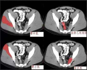 郑多燕十分钟减肥腹部 十分钟学会腹部CT解剖（多图）