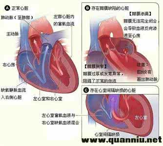 心脏杂音的听诊要点 心脏杂音 心脏杂音是怎么回事