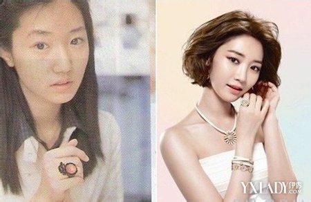 高俊熙整容前后 高俊熙整容前后 高俊熙整容前后曝光 冷艳美女全是浮云路人还不如