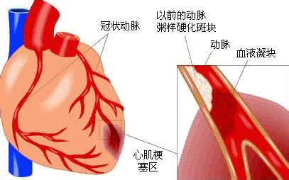 心脏有问题的症状 心脏有问题的症状 心脏有问题给身体带来哪些症状