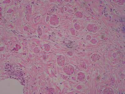 治疗外阴晚上痒小偏方 治疗外阴晚上痒小偏方 治疗外阴痒的几种小偏方