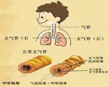 喉咙有痰咳不出咽不下 两个穴位治愈咽部有痰咳不出的苦恼