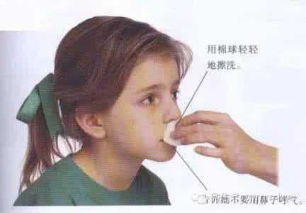 错误3194四种解决方法 孩子流鼻血 千万别用四种错误方法