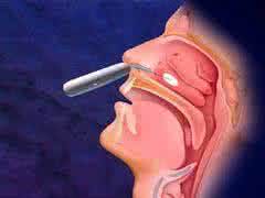 鼻窦炎能彻底治好吗 鼻窦炎能彻底治好吗 白癜风能彻底治好吗？