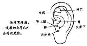 小野寺胃痛被高野发现 治胃痛胃痉挛的穴位——内关【小野寺点/耳穴/手穴】