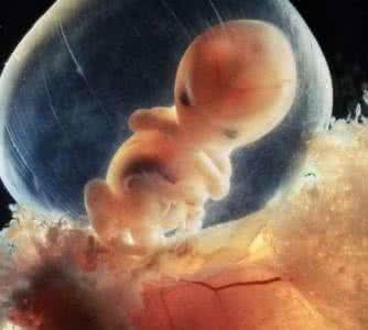 梦见胎儿死了 梦见胎儿死了 梦见胎儿