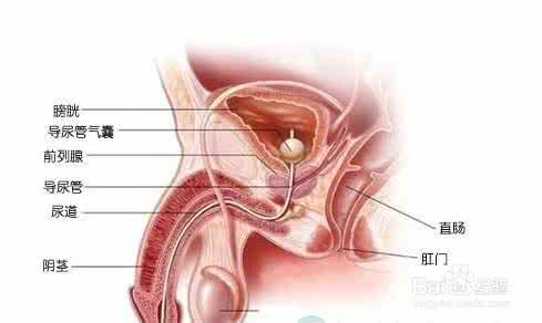 有效治疗前列腺炎 前列腺炎是什么 怎么有效治疗前列腺炎