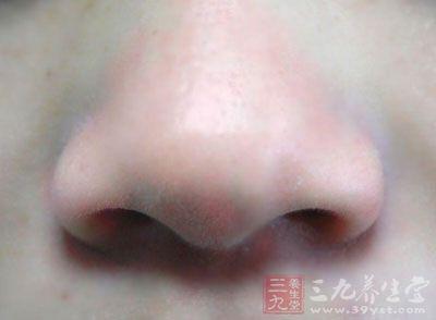 治疗鼻息肉 治疗鼻息肉 如何才能摆脱息肉