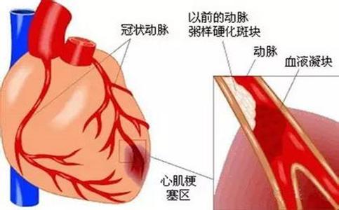 她是影帝女朋友甜糖 易漏诊的准糖友,说不定这里面就有你