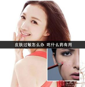 皮肤过敏吃什么药 皮肤过敏怎么办 吃什么药有用