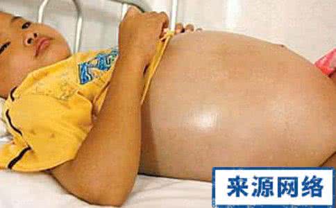 肝腹水治疗偏方 肝腹水症状 治疗肝腹水的小偏方