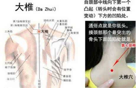 巧妙去除脚上的老茧 冠心病有一个妙穴在脚上