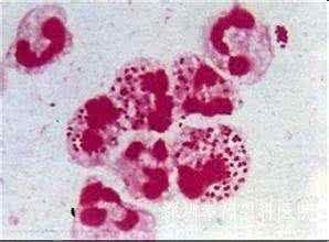 疱疹治疗最好的方法 女性疱疹 女性生殖器疱疹的治疗与预防