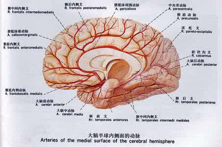 脑出血临终前的征兆 脑出血的五大突然征兆