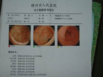 直肠炎的症状及治疗 直肠炎的症状及治疗 来认识一下