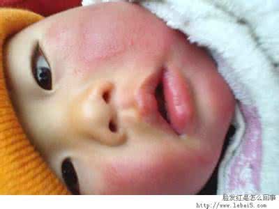 紧张脸红怎么办小妙招 紧张脸红怎么办小妙招?