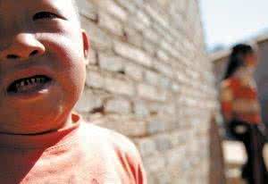 几岁掉牙 一般男孩几岁掉牙