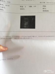 刚怀孕就见红了怎么办 怀孕初期出血怎么办