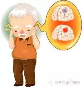 整天犯困一定是脑梗吗 总犯困当心是脑梗