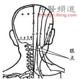 眼皮频繁跳动 图片：眼皮频繁跳动 按揉眼点穴