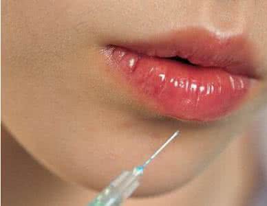 注射玻尿酸后有硬结 为什么玻尿酸会有硬结?