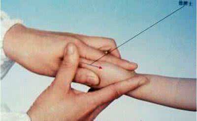 中华医药笔记 中华医药20150325视频和笔记:儿捏积,小儿腹泻