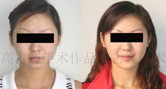 看起来很美 看起来很美 怎样让你的下巴看起来更美