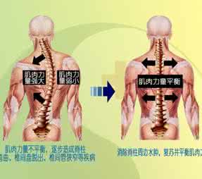 健康之路颈椎病治疗 颈椎病到底能不能根治?(健气神的回答,302赞)