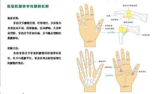 小针刀微创手术 针刀微创松解术临床图解