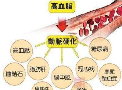 血管清道夫 三高怎么调理 它是“血管清道夫”，每天一勺调理三高防心血管病，一种病一个量