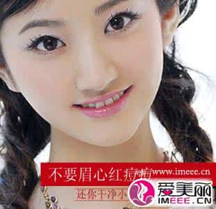 眉心长痘痘怎么调理 眉心长痘痘是什么原因_祛除需内外调理