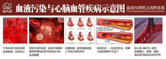 清洁血管的食物 血管的保健与清洁