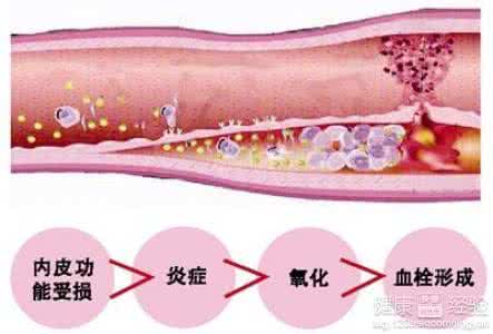 预防血管硬化的食物 预防血管硬化 多吃清理和保护血管的食物