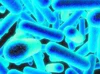 嗜肺军团菌 嗜肺性军团菌(Legionella pneumophila),能导致致死的军团病