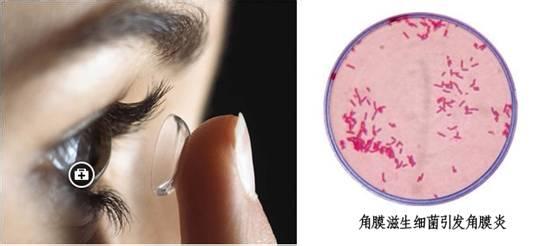 口臭看出身体内部疾病 从眼病可看出身体疾病