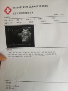肾积液 肾积液3方