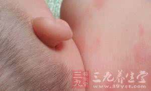 35岁女人用什么眼霜 女人这个部位35岁后手感变差