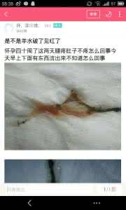 见红是不是胎盘剥离 临产前见红是什么意思