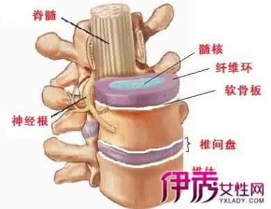 腰椎间盘突出症治疗 腰椎间盘突出症的治疗方法 腰椎间盘突出症的治疗