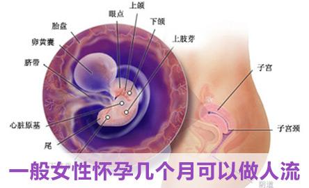 怀孕三个月能否做人流 怀孕三个月怎样做人流 怀孕三个月能否做人流