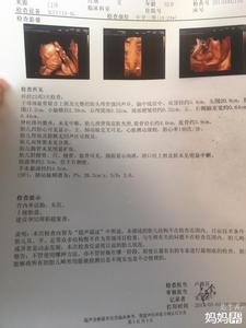 胎儿头围偏大 胎儿头围大有什么影响?