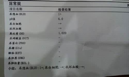 急性肾炎 慢性肾炎 急慢性肾炎、小儿急性肾炎、尿蛋白33方