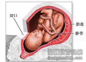 怀孕期间需要注意什么 怀孕期间有哪些危险需要注意？：1、早期怀孕出血与胚胎萎缩如何做