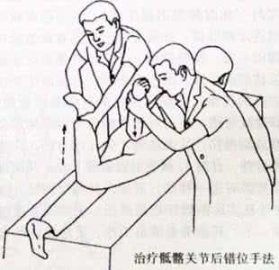 骶骨骨折分型 骶骨的错位分型和治疗手法(2)