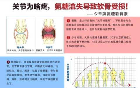 氨糖的功效 氨糖的功效 氨糖的功效，长期使用