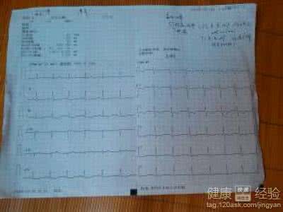 心脏早搏治疗方法 心脏早搏治疗方法 4个治疗心脏早搏验方 