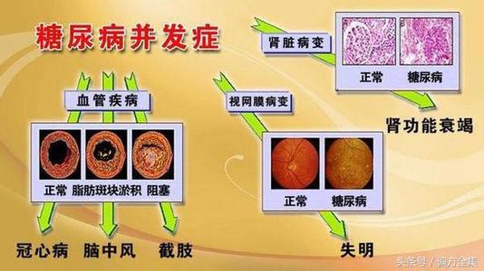 中医治疗糖尿病秘方 治糖尿病秘方 中医治疗糖尿病的方法有哪些