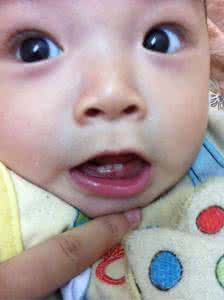 宝宝乳牙长歪了 怎么吃不影响宝宝长乳牙？