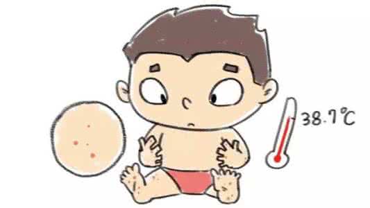 山东省卫计委 山东省卫计委提醒 冬季警惕水痘高发